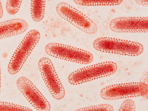 Original Gram-stained photomicrograph showing *Serratia marcescens*, a Gram-negative rod-shaped bacterium that produces red colonies and acts as a clinical opportunistic pathogen.