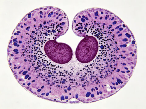 Micrograph of a human basophil stained with Wright-Giemsa, showing a characteristic bilobed nucleus and coarse, blackish-blue basophilic granules.