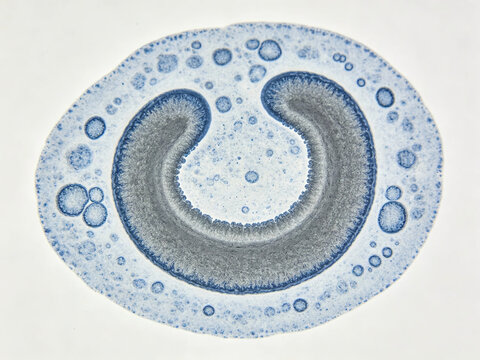 Wright-Giemsa stained photomicrograph of a human monocyte, showing a characteristic horseshoe-shaped nucleus and abundant grayish-blue cytoplasm with visible vacuoles.