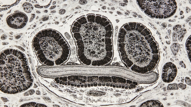 Original transmission electron microscopy (TEM) micrograph of skeletal muscle sarcoplasmic reticulum terminal cisternae, showing the typical triad structure that includes the transverse tubule.