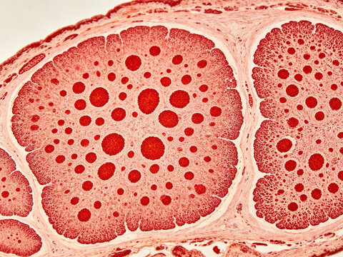 Native Oil Red O staining of neutral lipids in fatty liver, showing characteristic bright red lipid droplets within hepatocytes; native histochemical contrast.