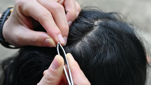 Someone using a tweezers for gripping and plucking gray hair from other woman head. Repeated plucking can damage the hair follicle and potentially cause the hair to thin.