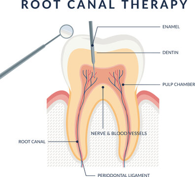 Detailed vector illustration of a tooth cross section showcasing root canal anatomy and dental instruments biological bone cavity cross section dentin