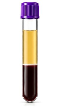 Centrifuged EDTA Blood Collection Tube Showing Plasma Buffy Coat and Packed Red Blood Cells Isolated on White Background