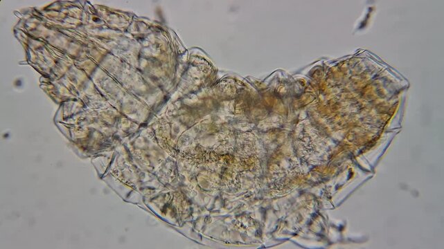 Tardigrade water bear moving under microscope at 400x magnification