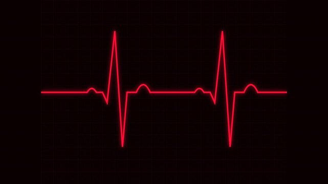 heartbeat flatline electrocardiogram red emergency alert warning signal animation for intensive care unit cardiac monitor 4k