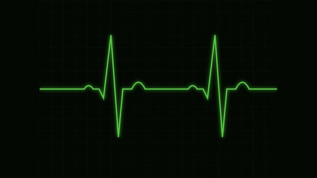 heartbeat flatline electrocardiogram seamless loop green scanning animation for emergency hospital medical screen in 4k