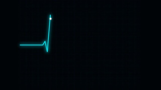 heartbeat flatline electrocardiogram tracing blue cyan vital sign signal on clinical diagnostic screen 4K loop