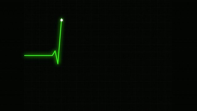 heartbeat flatline electrocardiogram sweeping green neon line on digital medical screen grid 4K loop