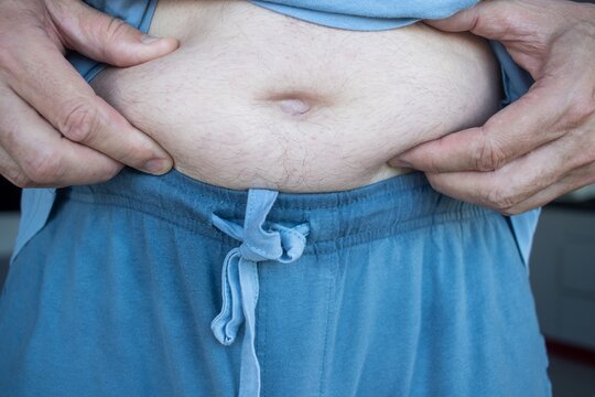 Middle-aged man accumulating abdominal fat due to excessive calorie intake, accumulation of abdominal fat, metabolic disorders, and obesity.