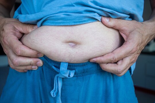 Middle-aged man accumulating abdominal fat due to excessive calorie intake, accumulation of abdominal fat, metabolic disorders, and obesity.