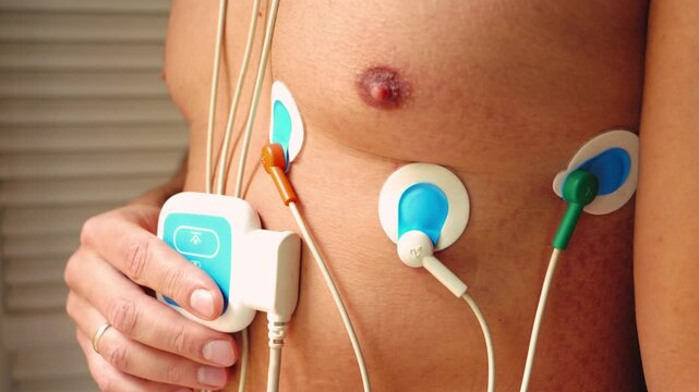 A man wearing a Holter monitor, a portable device that continuously records the heart's electrical activity, electrocardiogram. High quality 4k footage