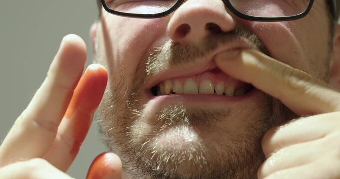 Man Showing Bleeding Gums Close Up