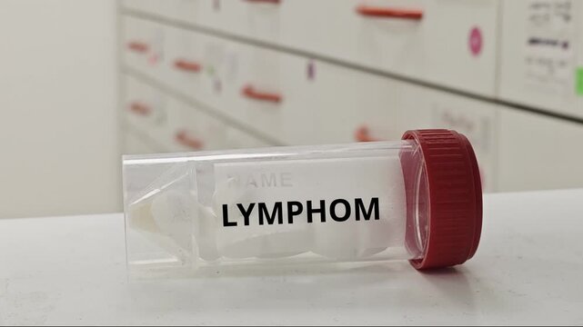 LYMPHOMA oncology treatment for chemotherapy targeted therapy immunotherapy or hormonal cancer treatment tablet taken by a patient