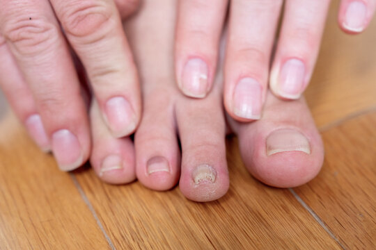 Bare human hand and foot placed side by side on a wooden floor comparing fingernail and toenail health in a home setting