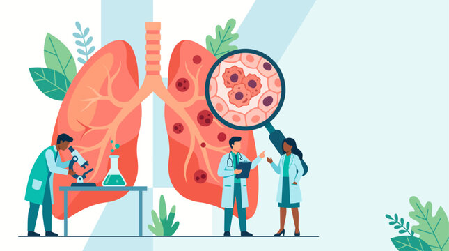 Medical illustration for world lung cancer day with doctors examining diseased lungs under magnifying glass and microscope