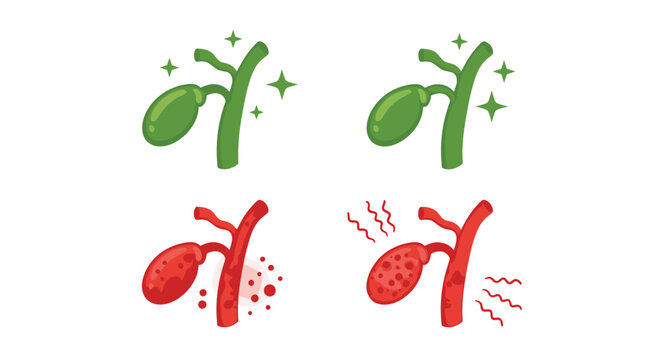 Medical illustration showing the comparison between a healthy green gallbladder and a diseased red gallbladder.