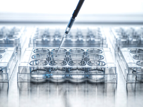 Medical sample being pipetted into microplate