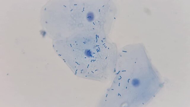 Microscope view of squamous epithelial cells with rod-shaped bacilli bacteria