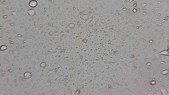Whipped cream under microscope, macro food science textures and bubbles close up