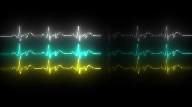 Animated video of a patient monitor screen displaying vital sign values, including heart rate, blood pressure, oxygen saturation, and respiratory rate. Healthcare, medical monitoring technology. 4k
