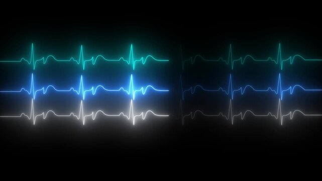 Animated video of a patient monitor screen displaying vital sign values, including heart rate, blood pressure, oxygen saturation, and respiratory rate. Healthcare, medical monitoring technology. 4k