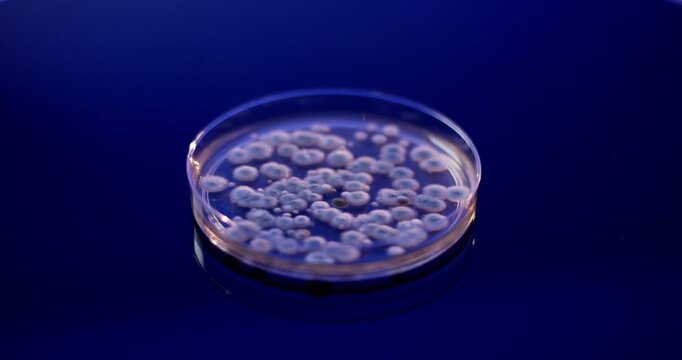 Close up of a petri dish containing a biological sample with multiple circular bacterial colonies
