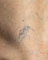 Fototapeta premium Blurry blue ink mark on human skin