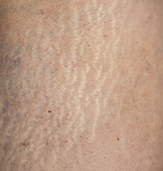 Fototapeta premium Close-up of human skin with visible texture and fine lines
