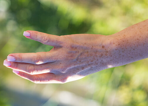 Hand with freckles, palm open, fingers slightly spread
