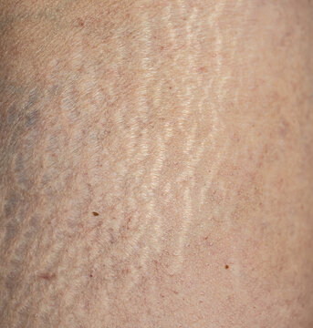 Close-up of human skin with visible texture and fine lines