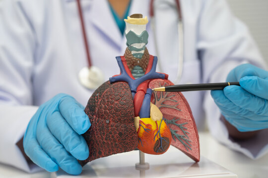 Pneumonia, lung cancer, Asian doctor holding human model.