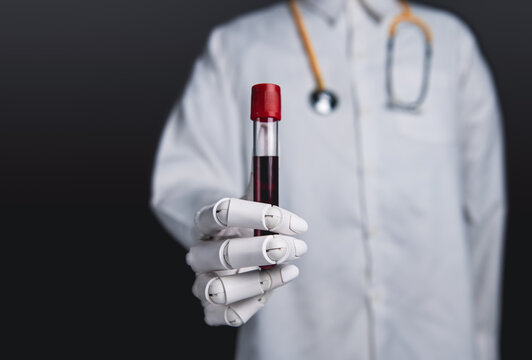 Robot doctor hand holding a blood sample test tube on dark background.
