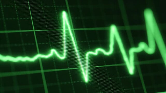 Medical professional analyzing a patient's heart rate on a monitor screen