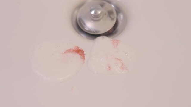 An image of toothpaste foam dripping into the bathroom sink, mixed with blood, signifies oral health issues such as gum disease or dental problems