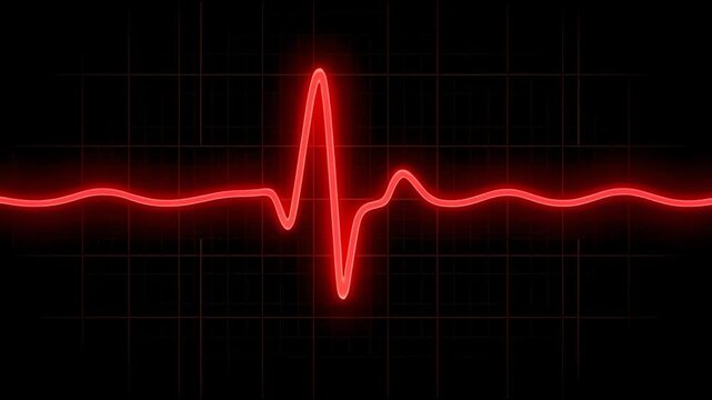A vibrant red waveform glows intensely against the darkened monitor screen representing the rhythmic electrical activity of a human heart during a medical examination performed within