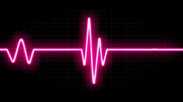 A glowing pink heartbeat monitor signal visualizes the rhythm of life on a dark display screen showing the electrical activity of a human heart to represent critical medical monitoring