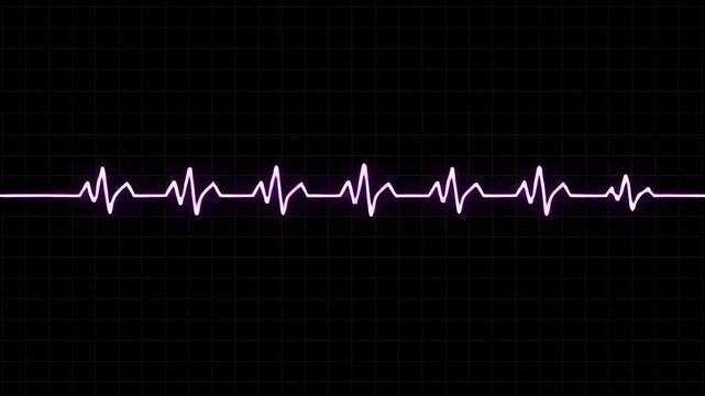 A vibrant digital monitor displays a continuous sequence of cardiac electrical activity patterns across a dark grid to represent vital signs and physiological rhythm during emergency medical