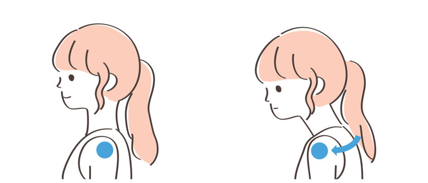 正常な位置の肩と巻き肩の人の比較イラスト｜バストトップ