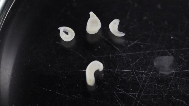 Clinostomum spp. are freshwater flukes with a worldwide distribution and a complex life cycle involving multiple hosts, including snails (intermediate hosts), fish or amphibians (secondary intermediat