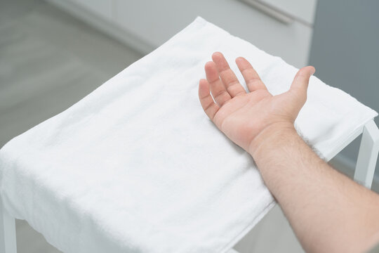 doctor makes a shot of botulinum toxin in the hand of a male palm against excessive sweating, treatment of hyperhidrosis