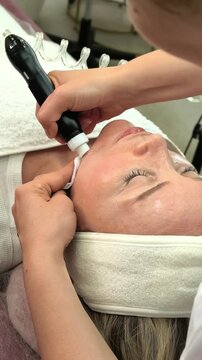 Close Up Vacuum Hydro Peel Treatment For Mature Woman
