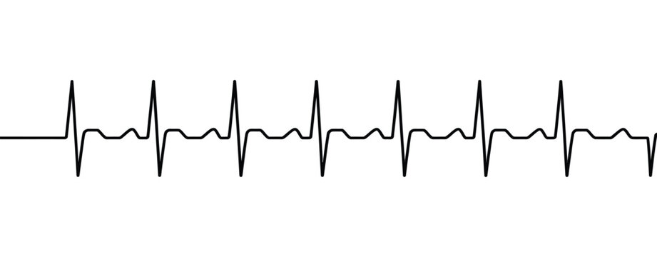 Electrocardiogram reading shows normal heartbeat rhythm medical ECG line graph displaying healthy cardiac activity on monitor screen