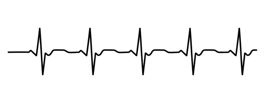 Electrocardiogram reading shows normal heartbeat tracing medical concept illustrating stable ECG waveform and cardiovascular health analysis