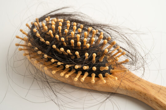 Hair loss fall with comb brush isolated on white background.