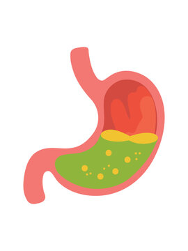 illustration of human stomach with digestive contents anatomy