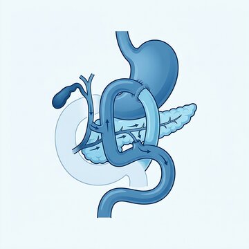 Whipple Procedure (Post-Surgery Anatomy), illustrating the reconstructed digestive tract including the pancreas, duodenum, and bile duct, technical medical schematic, blue, 