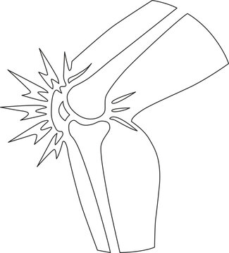 Broken elbow joint line drawing with impact lines white background