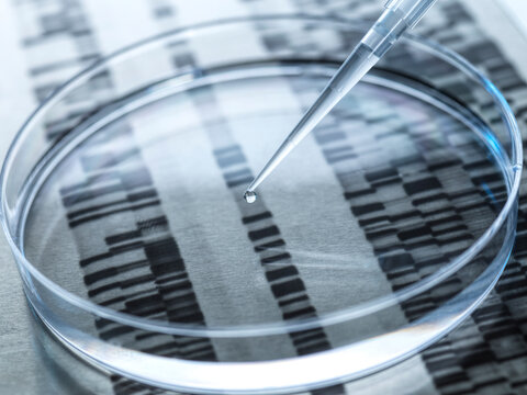 Experiment on DNA sample in petri dish with DNA results in background