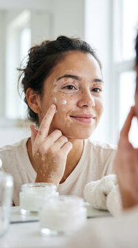 Morning skincare routine close-up of young woman with vitiligo skin applying cream dots on face smiling Dermatology condition and skin diversity home relaxing self care beauty ritual natural